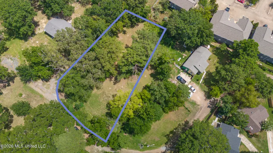 0 Woody Drive, Brandon, MS 39047 - #3
