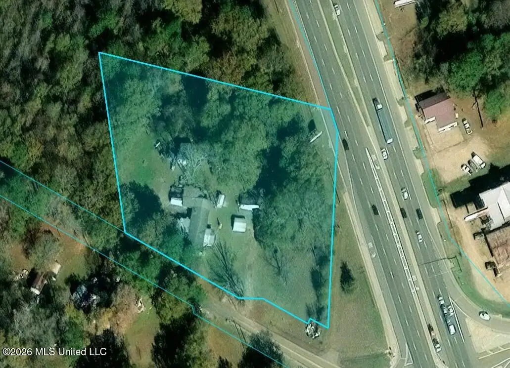 2.87 Acres U S Highway 49, Richland, MS 39218 - #1